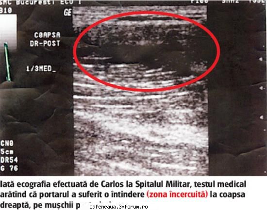 CARLOS A JUCAT ACCIDENTAT - CARLOS A JUCAT ACCIDENTAT Răzvan Rotaru, Dan - Sport